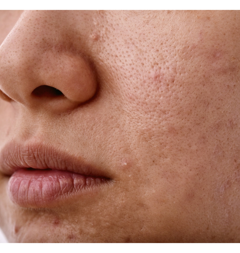 This Is Why Your Skin Isn’t Glowing