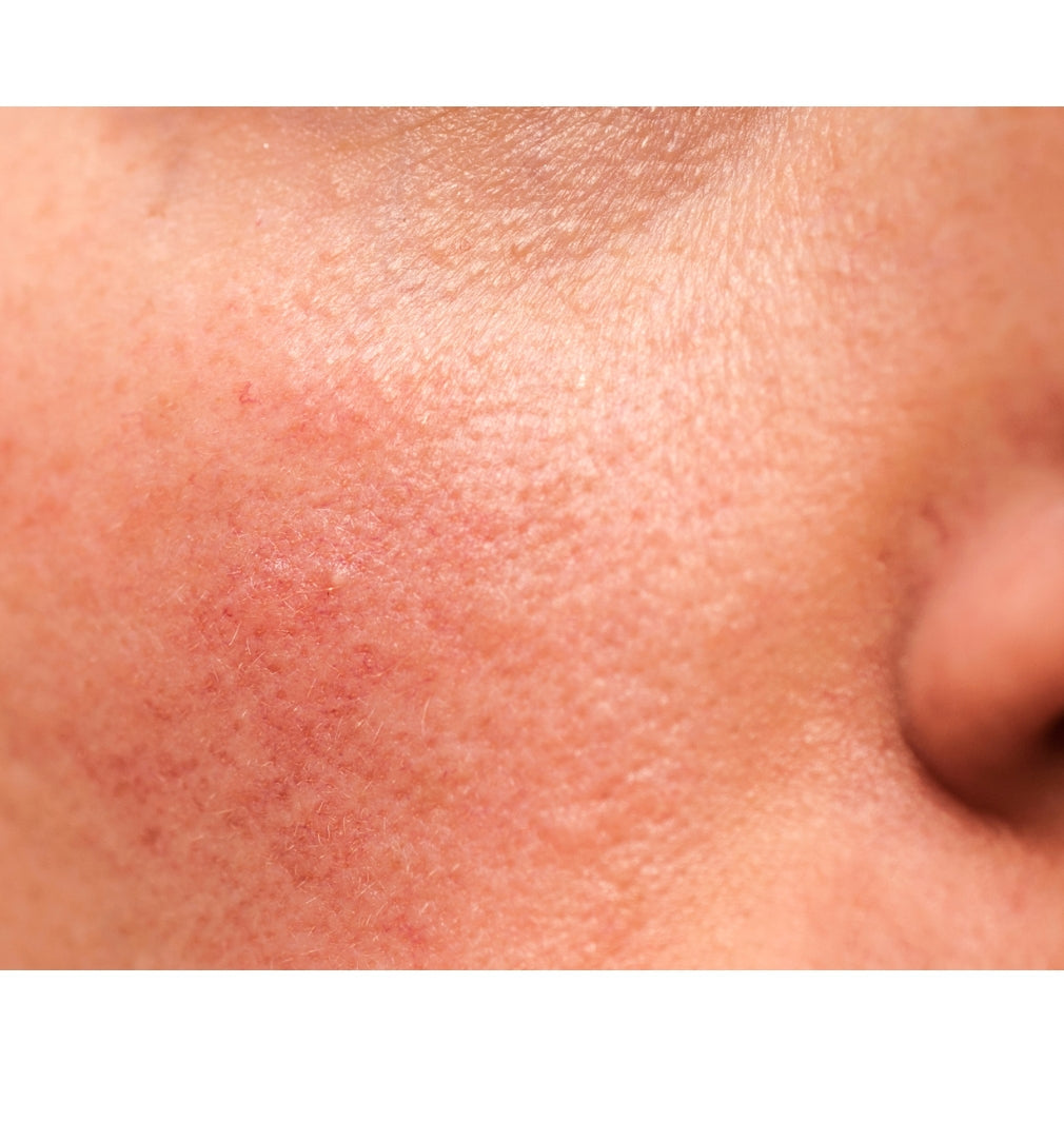 3 Skincare Mistakes Ruining Your Skin