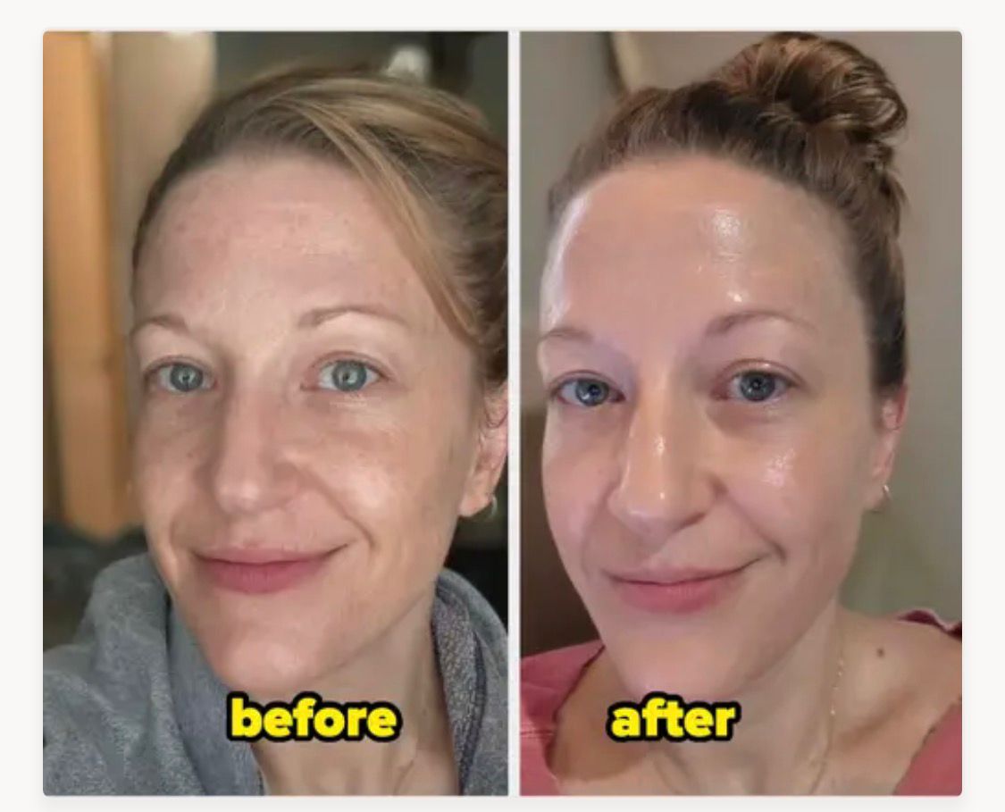 Everyone Wants Glowing Skin… But Nobody Is Doing This
