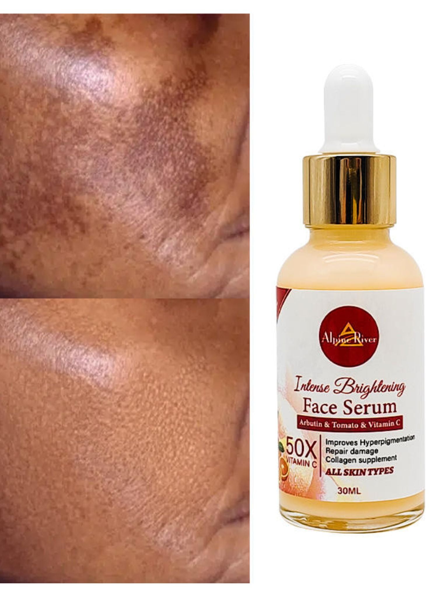 Vitamin C Korean Skin Whitening and Dark Spot 30ml