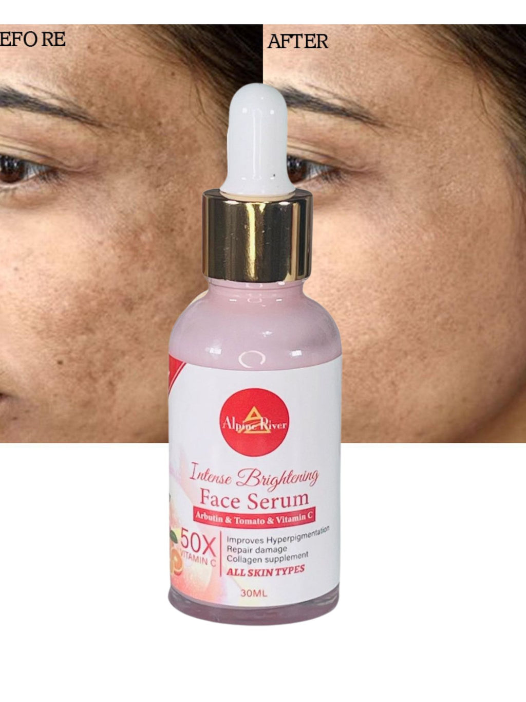 Intense Brightening 50X Vitamin C Face & Body Set – Soap, Serum & Cream for Radiant Skin